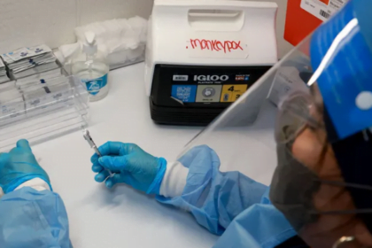 تسجيل أول حالة وفاة بفيروس جدري ألاسكا وتحذيرات من انتقال العدوى