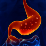 كيف تميز أعراض التهاب المريء عن غيرها؟