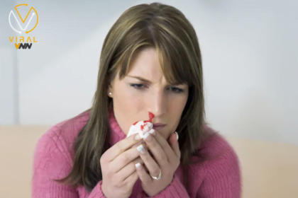 ما هي متلازمة أوسلر وويبر وريندو؟