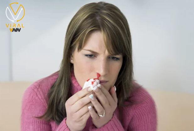 ما هي متلازمة أوسلر وويبر وريندو؟