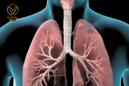 كيفية التعامل مع التهاب الشعب الهوائية الحاد