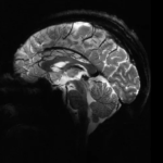 تقنية تصوير الدماغ بدقة فائقة باستخدام أحدث أجهزة الرنين المغناطيسي