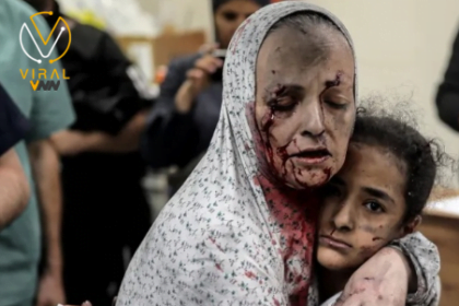 32 شهيد خلال 24 ساعة و34388 منذ بداية الصراع