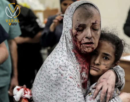 32 شهيد خلال 24 ساعة و34388 منذ بداية الصراع