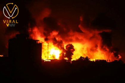 استشهاد طفلين جراء قصف على مدينة غزة