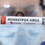 نقص لقاح جدري القرود في إفريقيا